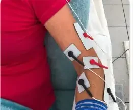 Klebeelektroden bei einer Mikrostromanwendung am Ellbogen